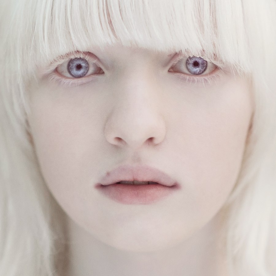 Nastya Zhidkova é a albina mais linda do mundo
