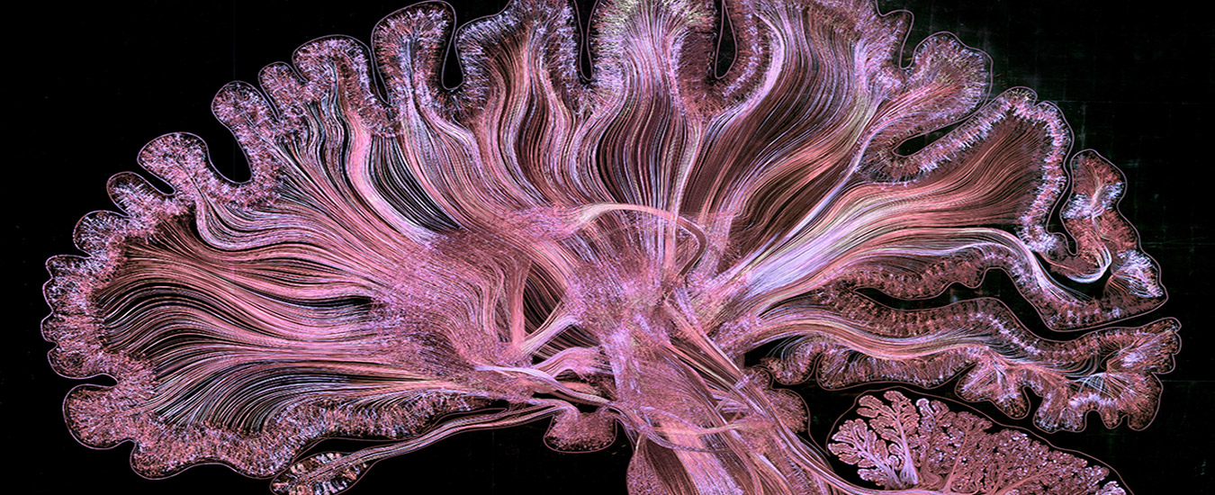 Projeto mostra a complexidade do cérebro humano em imagens
