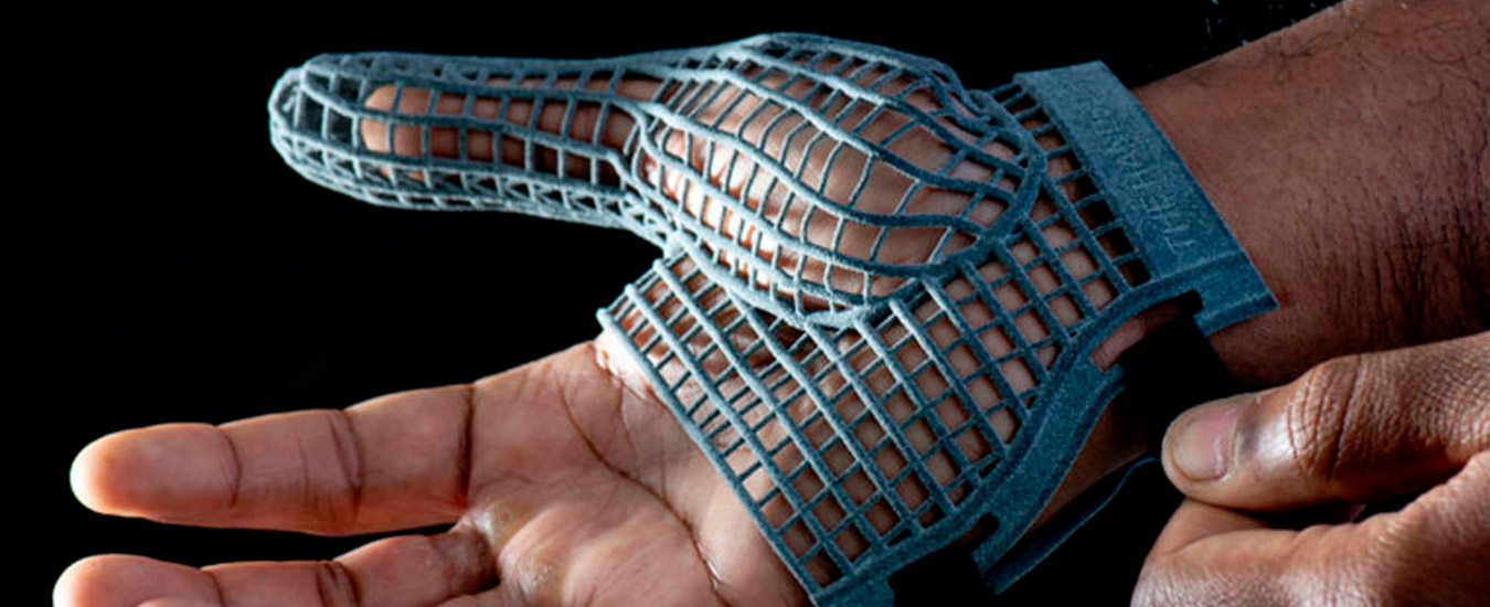 Luva impressa em 3D age contra problemas musculares e esqueléticos