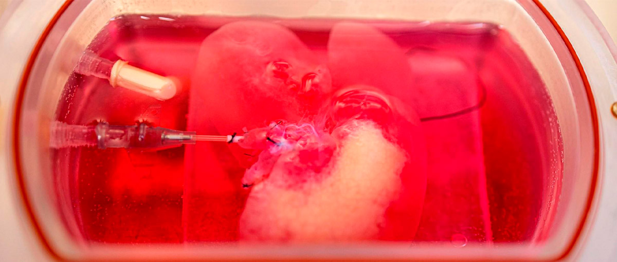 Fígado humano em miniatura é criado por cientistas brasileiros