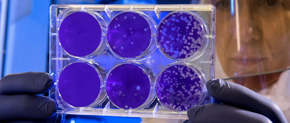 Cientistas conseguem gravar dados no DNA de bactérias vivas