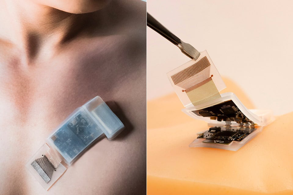 Adesivo ultrassônico sem fio pode ser divisor de águas para monitoramento corporal