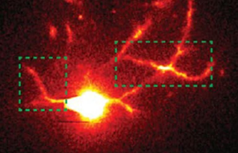 Engenheiros do MIT usam nova tecnologia de microscópio para observar sinapses no cérebro vivo