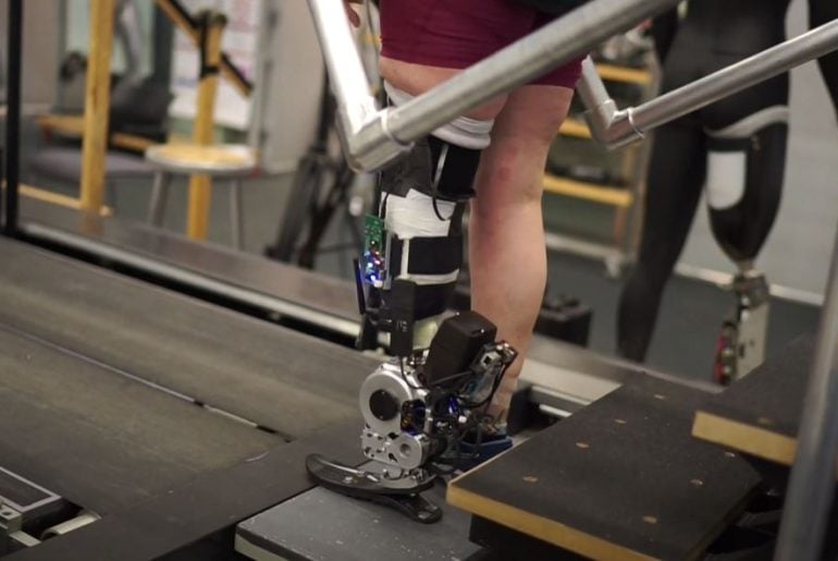 Prótese inovadora ajuda deficientes a andar naturalmente usando algoritmos