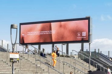 Outdoor que queima com o sol mostra em tempo real os danos da exposição sem protetor solar