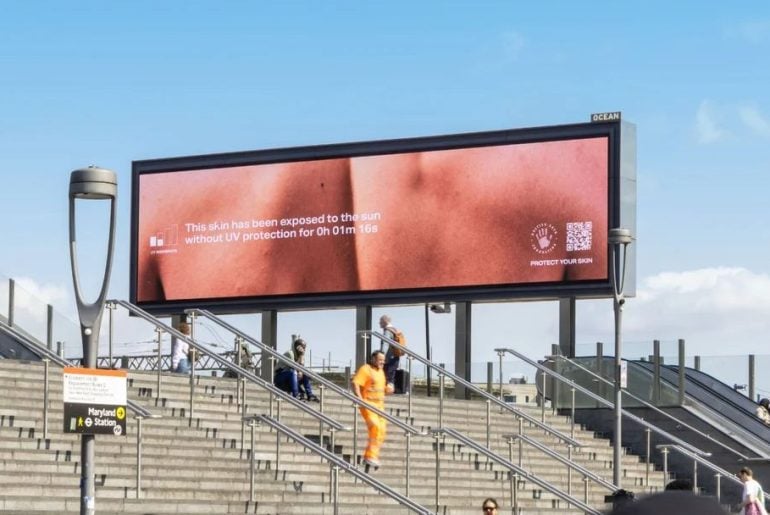 Outdoor que queima com o sol mostra em tempo real os danos da exposição sem protetor solar
