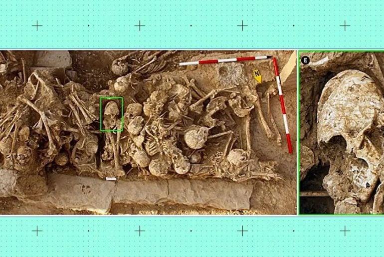 Cientistas se intrigam com crânio em formato de cone encontrado em antigo cemitério no Irã