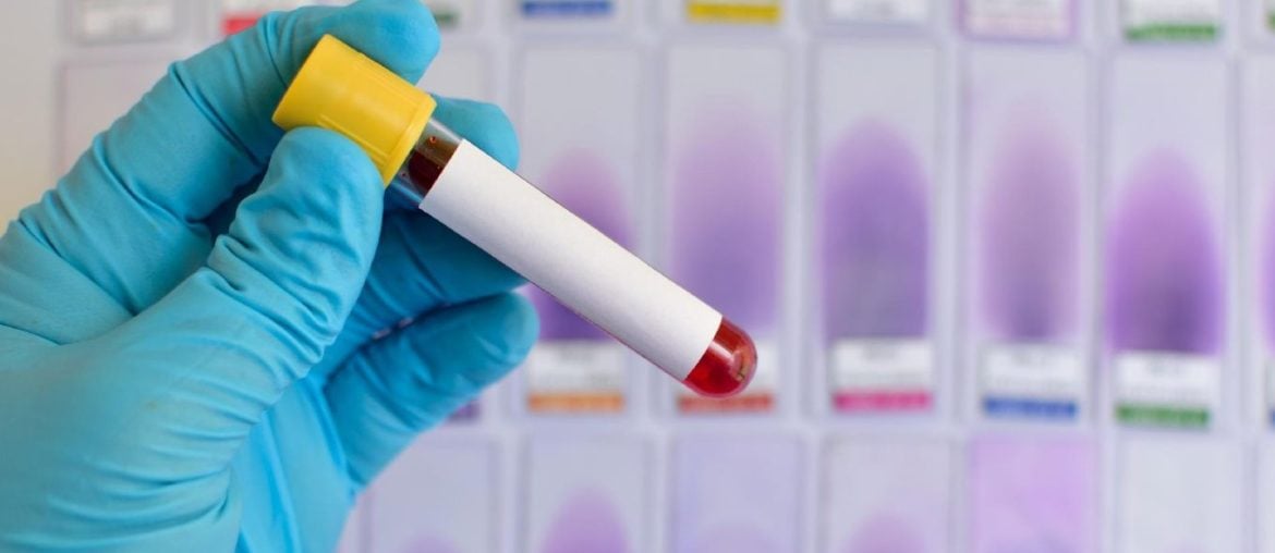 Japão desenvolve sangue artificial universal que pode ser usado por qualquer tipo sanguíneo