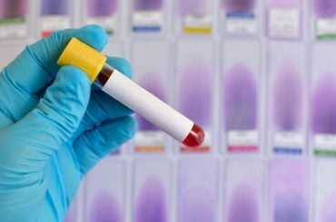Japão desenvolve sangue artificial universal que pode ser usado por qualquer tipo sanguíneo
