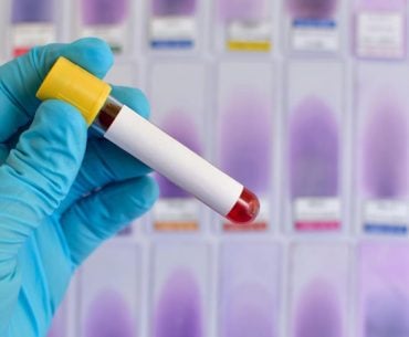 Japão desenvolve sangue artificial universal que pode ser usado por qualquer tipo sanguíneo