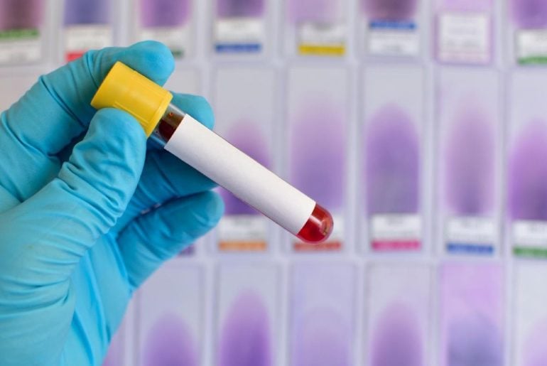Japão desenvolve sangue artificial universal que pode ser usado por qualquer tipo sanguíneo