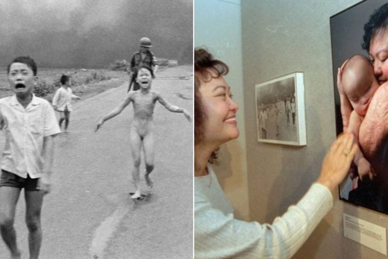 ‘Menina do Napalm’ recebe último tratamento 50 anos após foto que chocou o mundo