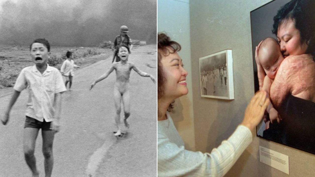 ‘Menina do Napalm’ recebe último tratamento 50 anos após foto que chocou o mundo