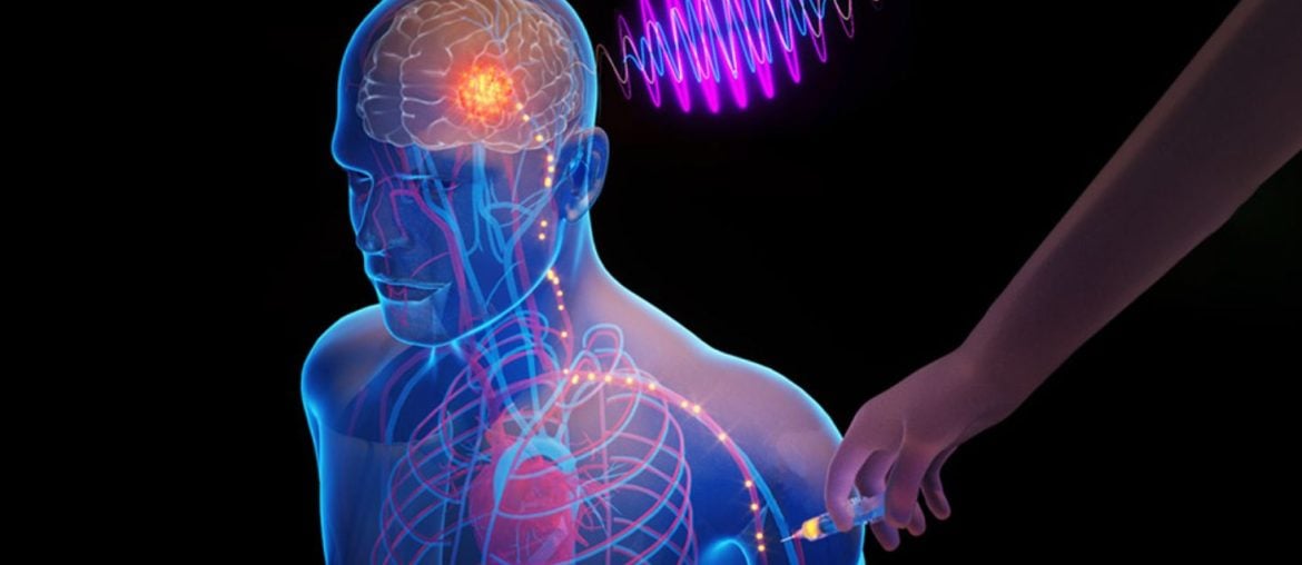 MIT cria chips injetáveis que viajam até o cérebro, e podem revolucionar tratamentos sem cirurgia