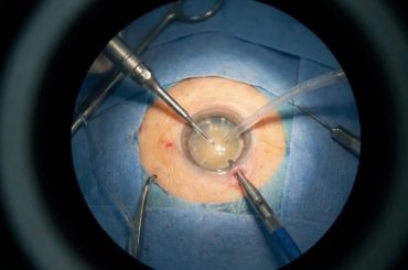 Apple Vision Pro entra na sala de cirurgia e é usado pela primeira vez em operação de catarata