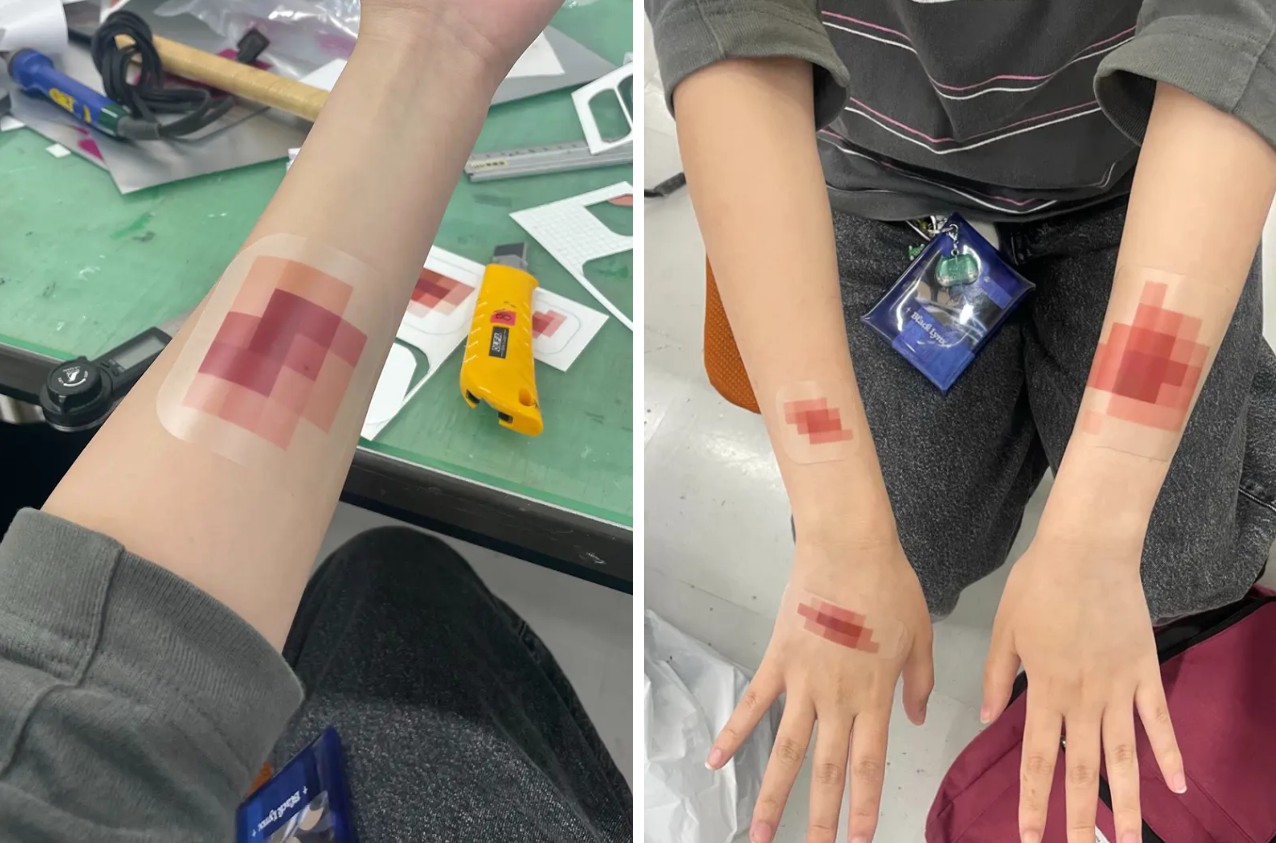 Band-aid de censura esconde o machucado que nem desfoque em vídeos