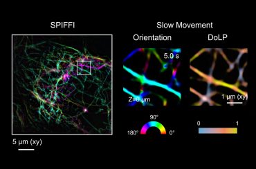 Novo microscópio SPIFFI pode transformar imagens de células vivas em vídeos de super resolução