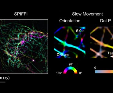 Novo microscópio SPIFFI pode transformar imagens de células vivas em vídeos de super resolução