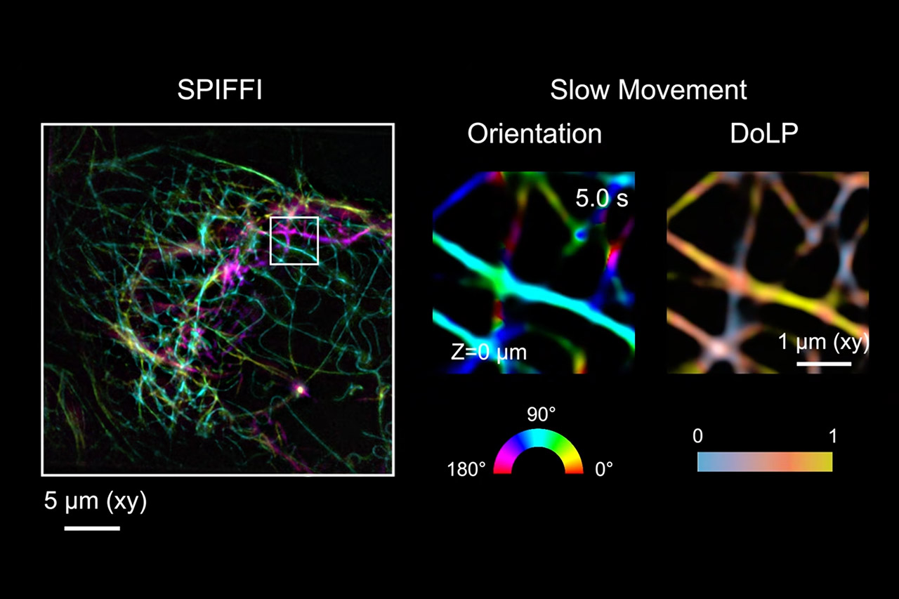 Novo microscópio SPIFFI pode transformar imagens de células vivas em vídeos de super resolução